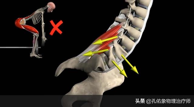 腰肌劳损的自我治疗和恢复（腰肌劳损反复发作）(6)