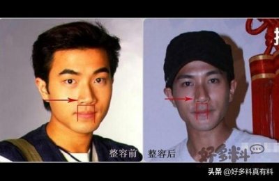 ​网曝刘恺威前后对比照差别太大(刘恺威整容对比照)