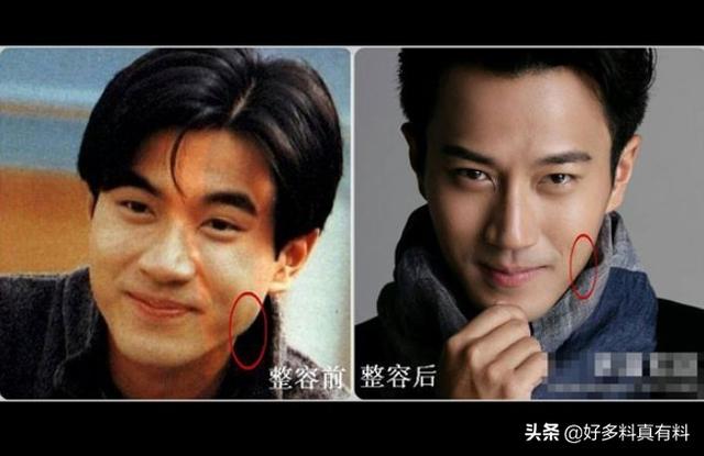刘恺威整容对比照(网曝刘恺威前后对比照差别太大)(3)