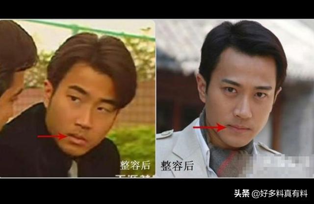 刘恺威整容对比照(网曝刘恺威前后对比照差别太大)(2)